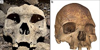 В Габоне обнаружено средневековое массовое захоронение людей с удаленными зубами на верхней челюсти