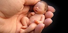 Число абортов за прошлый год сопоставимо с общим числом смертей, – ВОЗ